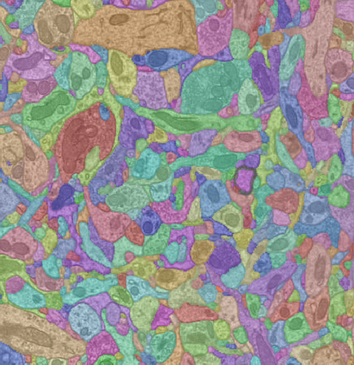 Electron Microscopy Processing